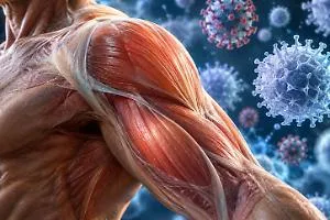 Rappresentazione della perdita di massa muscolare legata alla sarcopenia e vulnerabilità alle infezioni